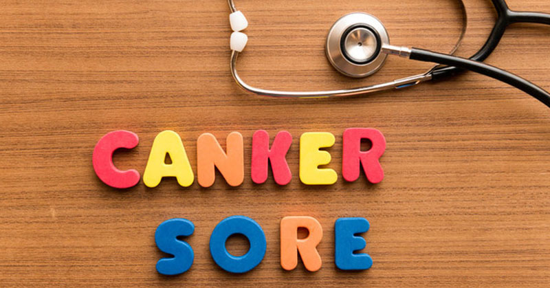 canker sore