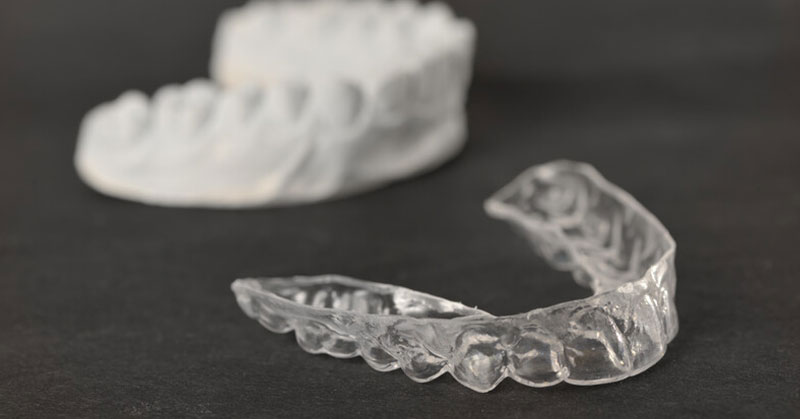 clear aligners