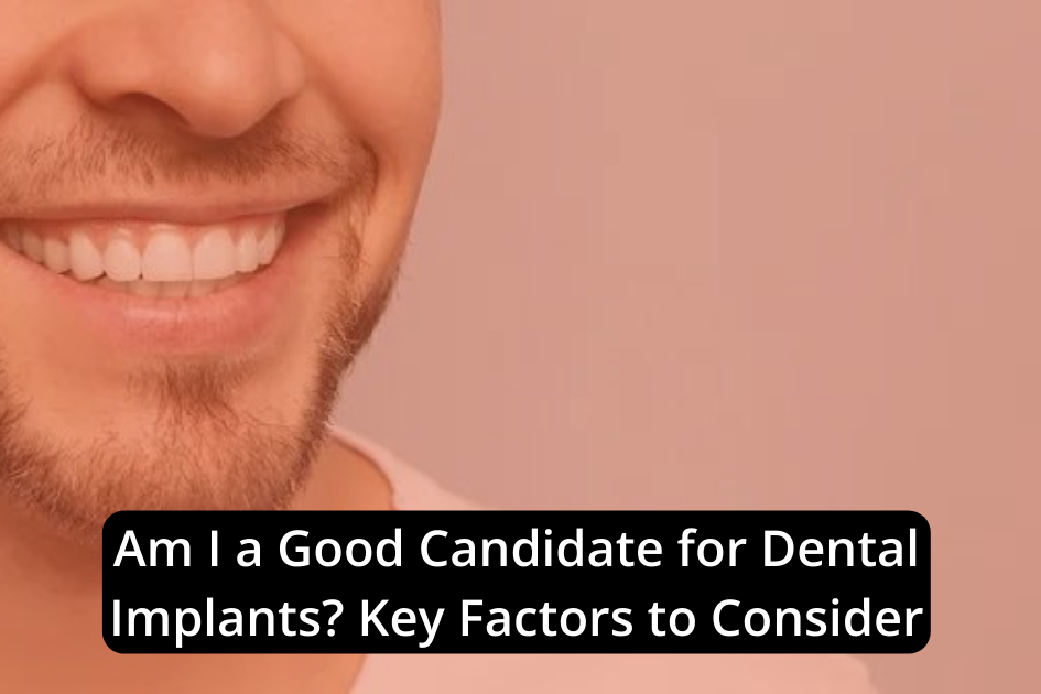 Close-up of a smiling individual's lower face with a beard, alongside text reading, "Am I a Good Candidate for Dental Implants? Key Factors to Consider.