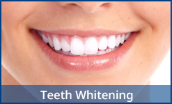 Teeth Whitening